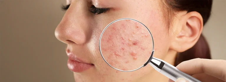 10 Common Skin Problems and Their Best Treatments