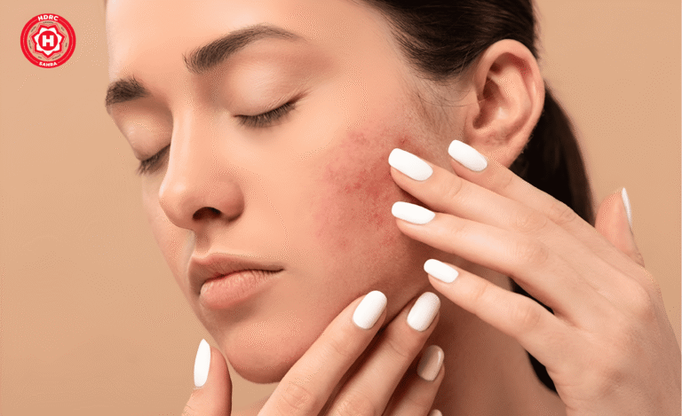 How to Reduce Dark Spots on Face