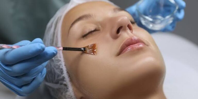 Chemical Peel for Skin Benefits, Types, Procedure & Aftercare