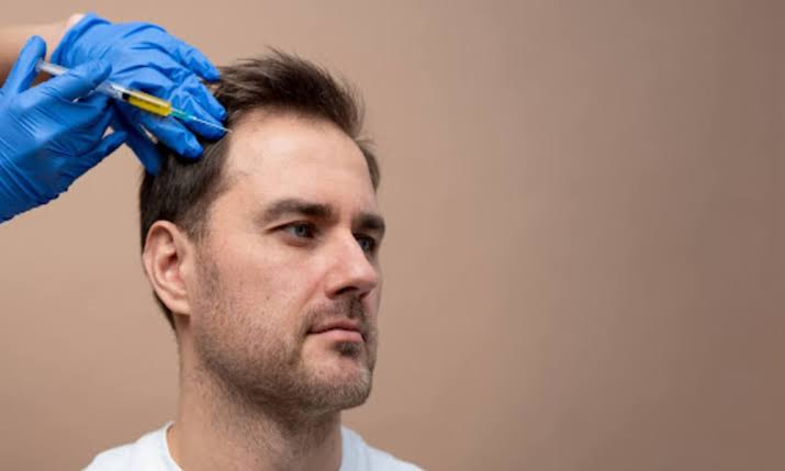 Hair Transplant vs PRP: Which Hair Loss Treatment Is Right for You?