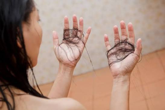 Oily Scalp and Hair Fall Can Excess Scalp Oil Affect Hair Health?